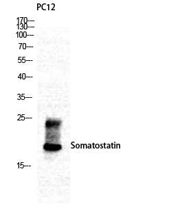 WB analysis of PC12 cell lysate using GTX34229 Somatostatin antibody.