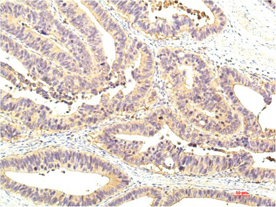 IHC-P analysis of human colon tissue using GTX34231 STAT1 antibody [8H11]. Dilution : 1:200