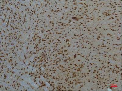 IHC-P analysis of mouse brain tissue using GTX34234 STAT3 antibody [3F4]. Dilution : 1:200