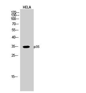 WB analysis of HeLa cell lysate using GTX34250 p35 antibody. WB analysis of HeLa cell lysate using GTX34250 p35 antibody.