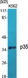 WB analysis of K562 cell lysate using GTX34250 p35 antibody.