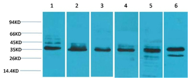 WB analysis of (1) HeLa, (2) 293T, (3) C2C12, (4) mouse liver, (5) PC12, (6) rat brain tissue lysates using GTX34252 TBP antibody. Dilution : 1:2000