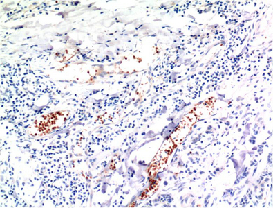 Immunohistochemistry (IHC) analysis of paraffin-embedded Mouse Lung Tissue using TGFbeta1 Mouse Monoclonal Antibody diluted at 1:200.