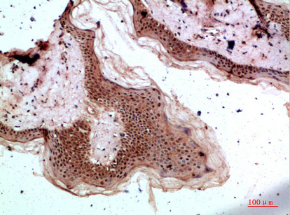 IHC-P analysis of human skin tissue using GTX34280 TPSD1 antibody. Dilution : 1:200