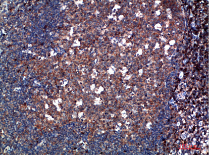 IHC-P analysis of human tonsil tissue using GTX34280 TPSD1 antibody. Dilution : 1:200