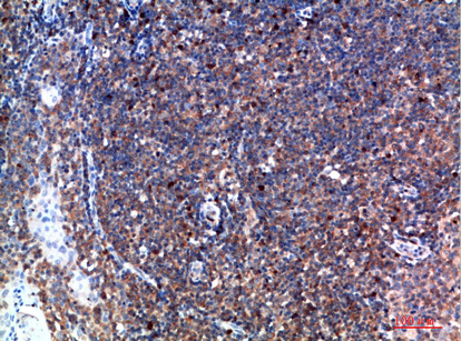 IHC-P analysis of human tonsil tissue using GTX34280 TPSD1 antibody. Dilution : 1:200
