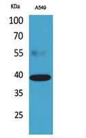 WB analysis of A549 cell lysate using GTX34291 CGR19 antibody. WB analysis of A549 cell lysate using GTX34291 CGR19 antibody.