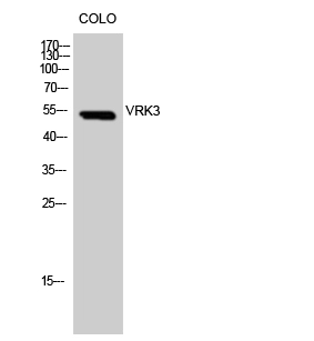 WB analysis of COLO205 cell lysate using GTX34294 VRK3 antibody. WB analysis of COLO205 cell lysate using GTX34294 VRK3 antibody.