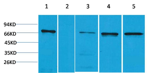 WB analysis of (1) HeLa, (2) Jurkat, (3) mouse brain, (4) mouse kidney, (5) rat brain lysates using GTX34302 ZNF499 antibody.