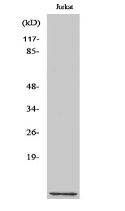 WB analysis of Jurkat cell lysate using GTX34316 CKS1 antibody. WB analysis of Jurkat cell lysate using GTX34316 CKS1 antibody.