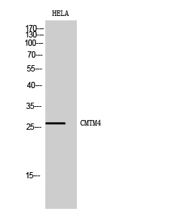 WB analysis of HeLa cell lysate using GTX34320 CMTM4 antibody. WB analysis of HeLa cell lysate using GTX34320 CMTM4 antibody.