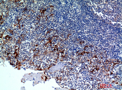 IHC-P analysis of human tonsils tissue using GTX34321 CMTM8 antibody. Dilution : 1:200 IHC-P analysis of human tonsils tissue using GTX34321 CMTM8 antibody. Dilution : 1:200