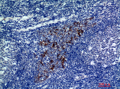 IHC-P analysis of human tonsils tissue using GTX34321 CMTM8 antibody. Dilution : 1:200