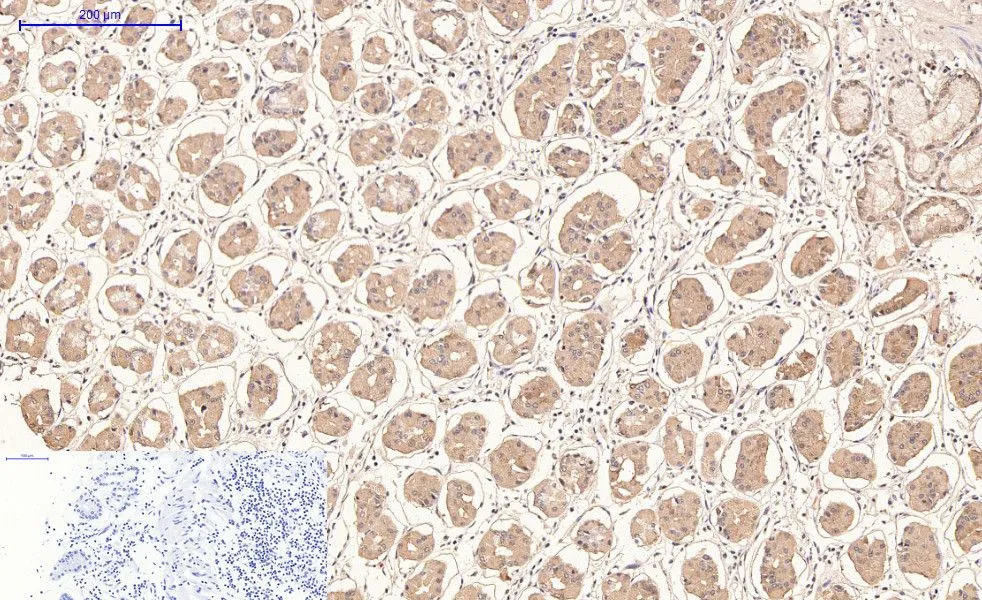 IHC-P analysis of human stomach tissue using GTX34330 CD21 antibody [2C5]. Negative control (the lower left coner) was secondary antibody only. Antigen retrieval : Sodium citrate pH6.0 was used for antibody retrieval (>98oC, 20min) Dilution : 1:200
