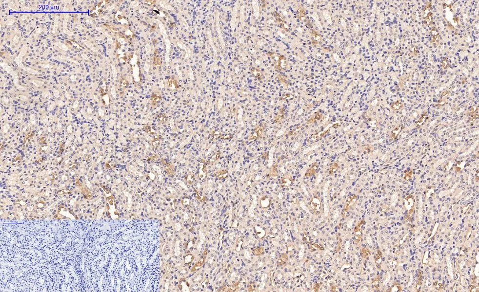 IHC-P analysis of mouse kidney tissue using GTX34330 CD21 antibody [2C5]. Negative control (the lower left coner) was secondary antibody only. Antigen retrieval : Sodium citrate pH6.0 was used for antibody retrieval (>98oC, 20min) Dilution : 1:200