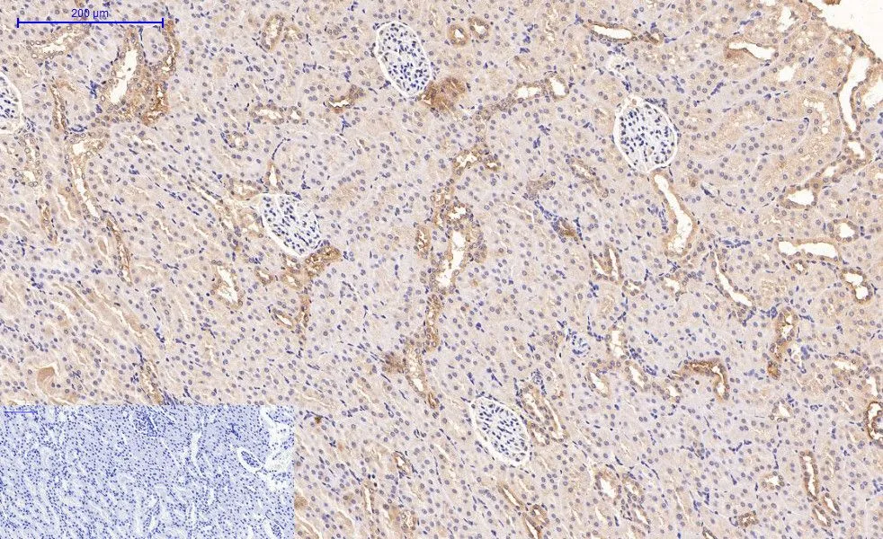 IHC-P analysis of rat kidney tissue using GTX34330 CD21 antibody [2C5]. Negative control (the lower left coner) was secondary antibody only. Antigen retrieval : Sodium citrate pH6.0 was used for antibody retrieval (>98oC, 20min) Dilution : 1:200