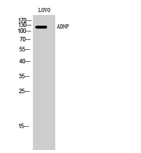 Western Blot (WB) analysis of LOVO cells using ADNP Polyclonal Antibody.