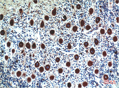 IHC-P analysis of human brain tissue using GTX34337 Cystatin C antibody [5F1]. Dilution : 1:200