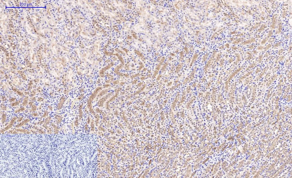 IHC-P analysis of mouse kidney tissue using GTX34339 beta Catenin antibody [4F2]. Negative control (the lower left coner) was secondary antibody only. Antigen retrieval : Sodium citrate pH6.0 was used for antibody retrieval (>98oC, 20min) Dilution : 1:200
