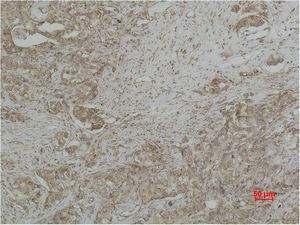 IHC-P analysis of human breast carcinoma tissue using GTX34345 Cytochrome C antibody [4B10].