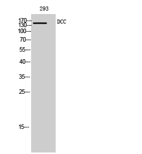 WB analysis of 293 cell lysate using GTX34348 DCC antibody. WB analysis of 293 cell lysate using GTX34348 DCC antibody.