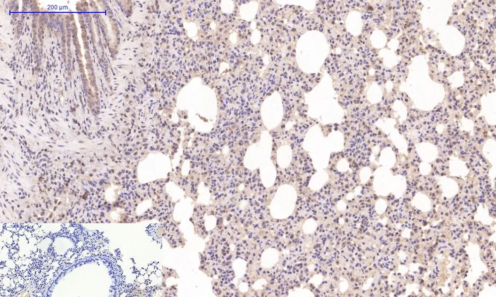 IHC-P analysis of mouse lung tissue using GTX34350 Desmin antibody [1B12]. Negative control (the lower left coner) was secondary antibody only. Antigen retrieval : Sodium citrate pH6.0 was used for antibody retrieval (>98oC, 20min) Dilution : 1:200