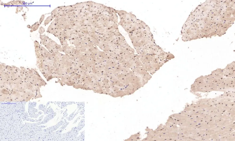 IHC-P analysis of rat heart tissue using GTX34350 Desmin antibody [1B12]. Negative control (the lower left coner) was secondary antibody only. Antigen retrieval : Sodium citrate pH6.0 was used for antibody retrieval (>98oC, 20min) Dilution : 1:200