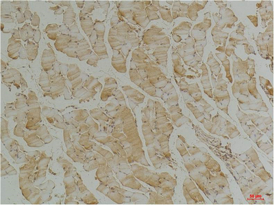 IHC-P analysis of mouse heart tissue using GTX34350 Desmin antibody [1B12]. Dilution : 1:200