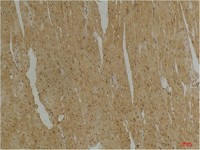 IHC-P analysis of mouse skeletal muscle tissue using GTX34350 Desmin antibody [1B12]. Dilution : 1:200
