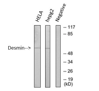 WB analysis of HeLa and HepG2 cell lysates using GTX34350 Desmin antibody [1B12].