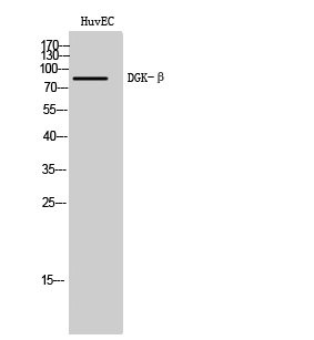 WB analysis of HuvEc cell lysate using GTX34351 DGKB antibody. WB analysis of HuvEc cell lysate using GTX34351 DGKB antibody.