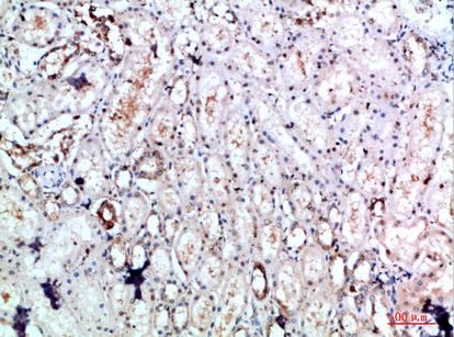 IHC-P analysis of human kidney tissue using GTX34355 DLEU7 antibody. Dilution : 1:200 IHC-P analysis of human kidney tissue using GTX34355 DLEU7 antibody. Dilution : 1:200