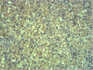 IHC-P analysis of mouse liver tissue using GTX34367 EPG5 antibody. IHC-P analysis of mouse liver tissue using GTX34367 EPG5 antibody.