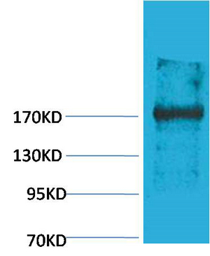 WB analysis of rat liver tissue lysate using GTX34367 EPG5 antibody.