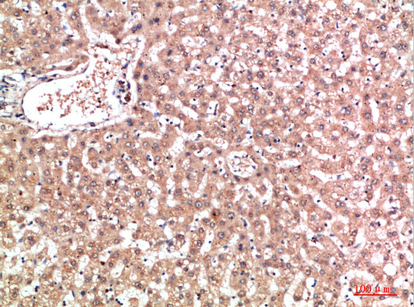 IHC-P analysis of human liver tissue using GTX34368 EPG5 antibody. Dilution : 1:200