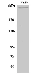 WB analysis of HuvEc cell lysate using GTX34370 Factor VIII antibody. WB analysis of HuvEc cell lysate using GTX34370 Factor VIII antibody.