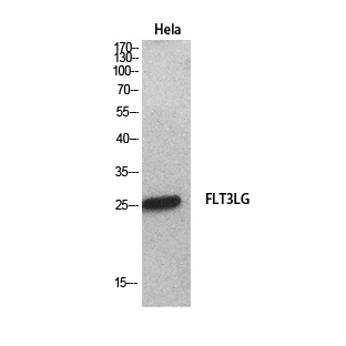 WB analysis of HeLa cell lysate using GTX34380 Flt3 Ligand antibody. WB analysis of HeLa cell lysate using GTX34380 Flt3 Ligand antibody.