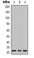 WB analysis of HEK293T (A), HepG2 (B), A549 (C) whole cell lysates using GTX34386 K-Ras antibody. WB analysis of HEK293T (A), HepG2 (B), A549 (C) whole cell lysates using GTX34386 K-Ras antibody.