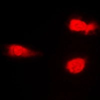ICC/IF analysis of formalin-fixed NIH3T3 cells using GTX34387 JNK (phospho Thr183) antibody. Red : Primary antibody Blue : DAPI Permeabilization : 0.1% Triton X-100 in TBS for 5-10 minutes ICC/IF analysis of formalin-fixed NIH3T3 cells using GTX34387 JNK (phospho Thr183) antibody. Red : Primary antibody Blue : DAPI Permeabilization : 0.1% Triton X-100 in TBS for 5-10 minutes