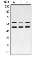 WB analysis of PMA-treated MCF7 (A), UV-treated NIH3T3 (B), PMA-treated PC12 (C) whole cell lysates using GTX34387 JNK (phospho Thr183) antibody.