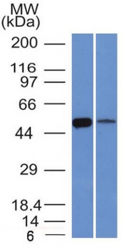 WB analysis of K562 and lung lysates using GTX34400 ALDH1A1 antibody [ALDH1A1/1381].