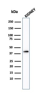 WB analysis of kidney tissue lysate using GTX34409 AMACR antibody.