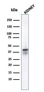WB analysis of kidney tissue lysate using GTX34410 AMACR antibody [AMACR/1723].