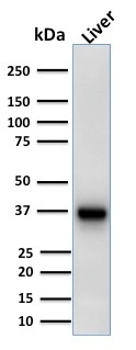 WB analysis of liver tissue lysate using GTX34410 AMACR antibody [AMACR/1723].