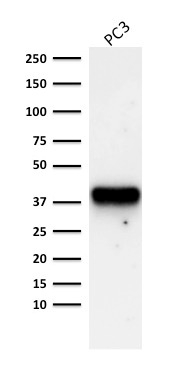WB analysis of PC3 cell lysate using GTX34410 AMACR antibody [AMACR/1723].