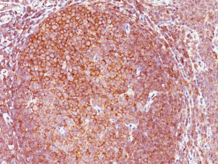 IHC-P analysis of human tonsil tissue using GTX34423 BCL10 antibody [BL10/411].