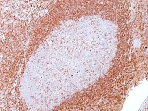 IHC-P analysis of human tonsil tissue using GTX34426 Bcl-2 antibody [SPM117].