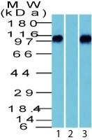 WB analysis of human brain (1) absence, or (2) presence of immunizing peptide, and (3) mouse brain lysates using GTX34438 beta Catenin antibody.