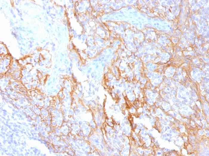 IHC-P analysis of human tonsil tissue using GTX34439 beta Catenin antibody [15B8].