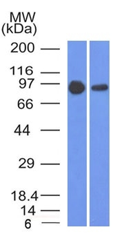 WB analysis of A431 and A549 cell lysates using GTX34440 beta Catenin antibody [5H10].